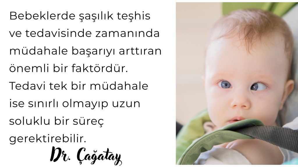 bebeklerde göz kayması tedavisi 