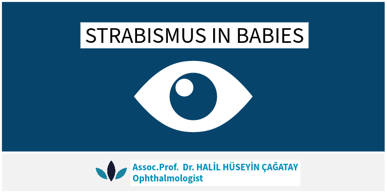 STRABISMUS IN BABIES
