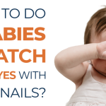 what to do if babies scracth their eyes with nails