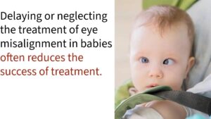 STRABİSMUS TREATMENT IN BABIES